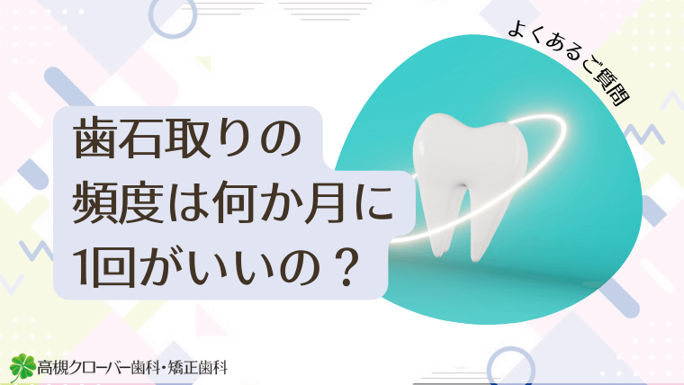 歯石取りの頻度は何か月に1回がいいの？