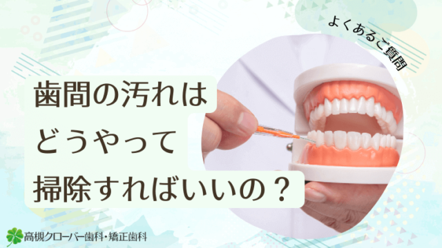 歯間の汚れはどうやって掃除すればいいの？