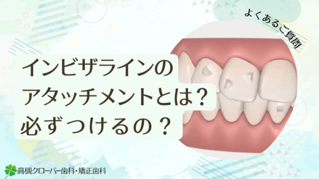 インビザラインのアタッチメントとは？必ずつけるの？