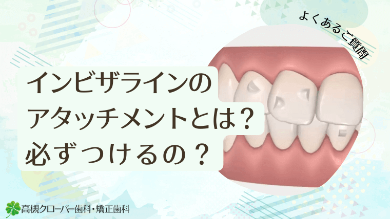 インビザラインのアタッチメントとは？必ずつけるの？